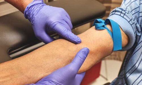 What you should not do before a blood test?
