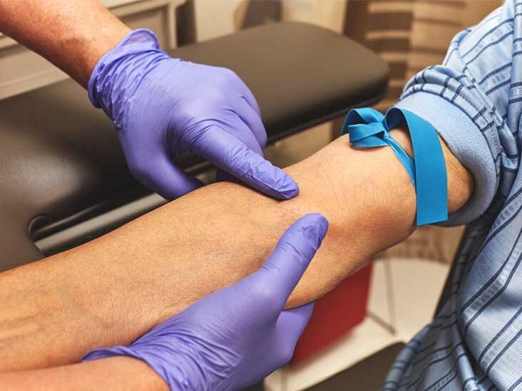 What You Should Do Before A Blood Test