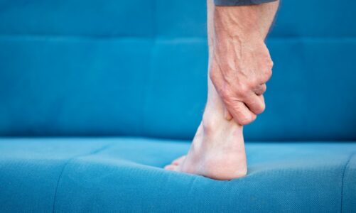 3 Signs You May Have Achilles Tendinitis