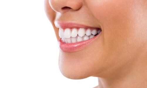 How Can You Unveil a New You Through a Smile Makeover?