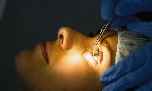 WHAT ARE THE CONDITIONS TREATED BY LASIK SURGERY?