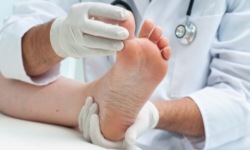 Exploring the Role of Podiatrists in Cardiff’s Healthcare System