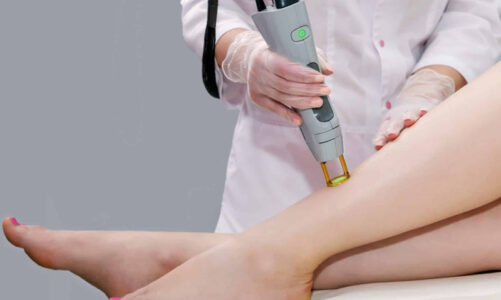 Why choose a certified practitioner for safe laser hair removal?