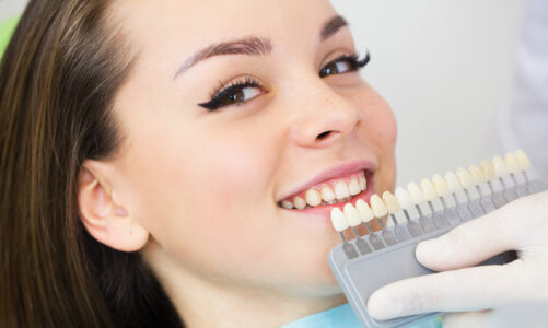 Common Cosmetic Dentistry Procedures Explained