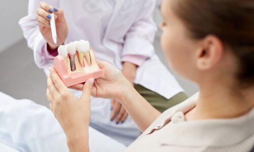 Difference Between A General Dentist And A Prosthodontist
