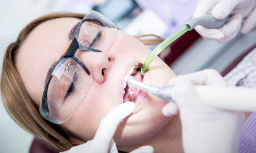 How To Prepare for A Successful Root Canal Treatment?