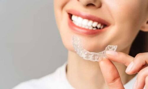 Unlocking Your Best Smile: The Role of Invisalign Doctors