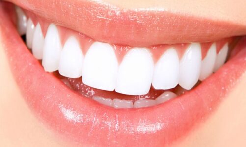 Revitalize Your Teeth the Magic of a Cosmetic Dentist