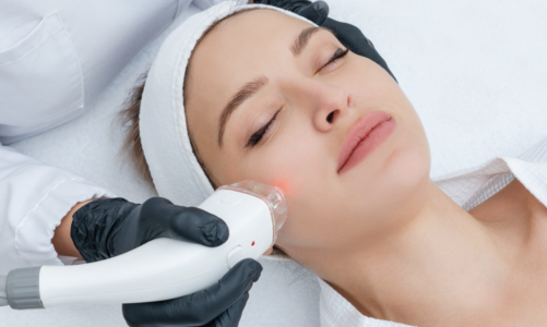 Achieve Radiant Perfection with Picosure Laser Technology