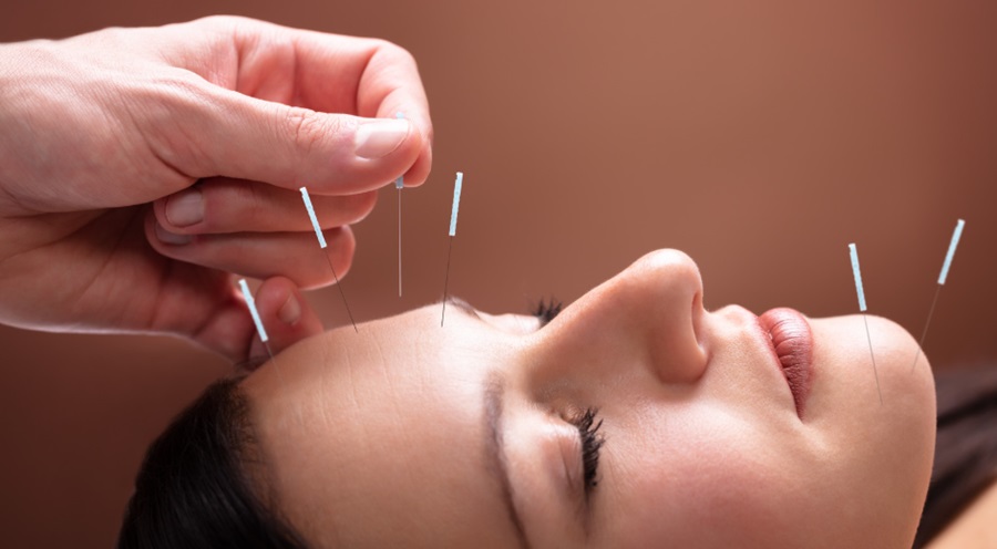 Facial Acupuncture