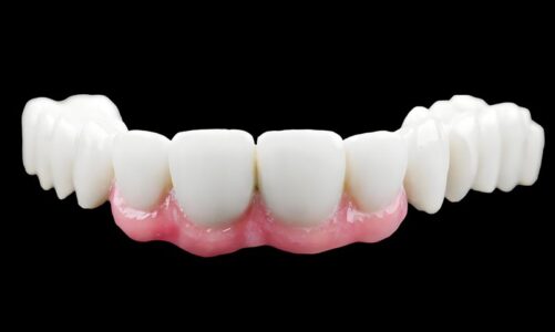 The Growing Demand for HT White Zirconia in High-Precision Dental Restorations