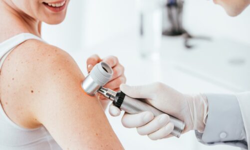 Early Detection Saves Lives: How Regular Skin Cancer Screenings Can Make All the Difference