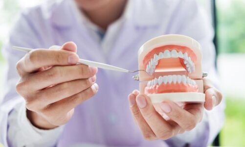 How General Dentistry Tracks And Manages Gum Health Over Time